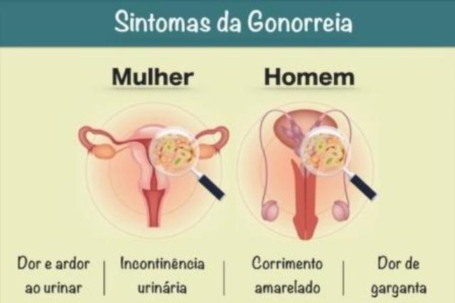 Foto de DOENÇAS GRAVES: clamídia e a gonorreia são responsáveis por cerca de 25% dos casos de infertilidade